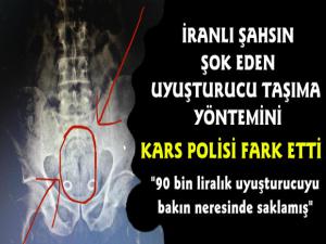 Kars'ta İranlı Adamın Makatından 90 Bin TL'lik Uyuşturucu Çıktı